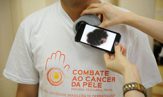 Quase 8% das pessoas infectadas têm manifestações cutâneas; Foto: Agência Brasil