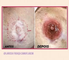 Tatuadora devolve autoestima a mulheres redesenhando a mama