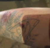 Corrida em carro de aplicativo acaba com motorista mordido pela passageira