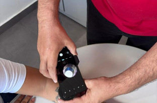 Telediagnóstico em dermatologia identifica casos de câncer de pele em MS
