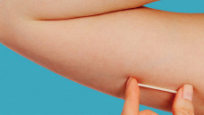 HU realiza mutirão com DIU e Implanon, mas atendimento seguirá critérios