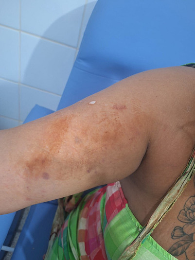 Briga por ciúmes termina com mulher ferida e homem preso em Dourados