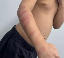 Jardineiro é preso em flagrante após espancar enteado de 5 anos com galho de amora