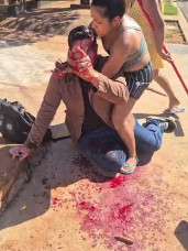 Jornalista é brutalmente agredido após deixar evento no Leste de MS